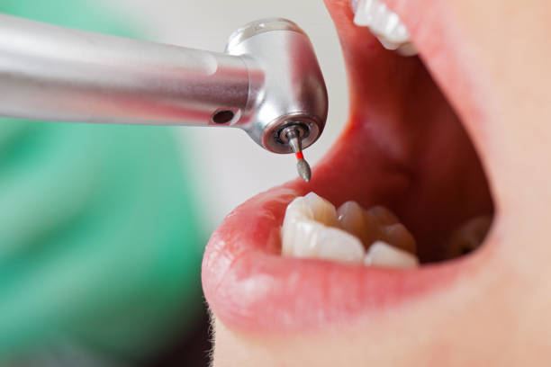 Reliable GA Emergency Dentist Solutions